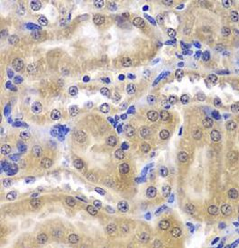 RPL5 Antibody