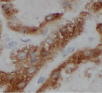 RPL7 Rabbit Polyclonal Antibody