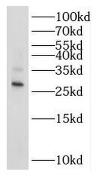RPL7L1 Rabbit Polyclonal Antibody