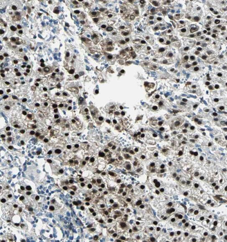 RPL7L1 Rabbit Polyclonal Antibody