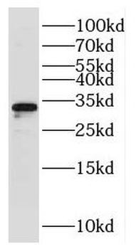 RPL8 Rabbit Polyclonal Antibody