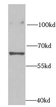 RPN2 Antibody