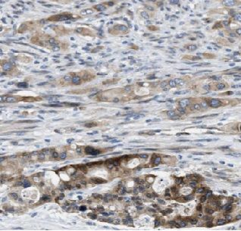 RPS28 Rabbit Polyclonal Antibody