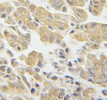 RPS3 Rabbit Polyclonal Antibody