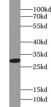 RPS4X Rabbit Polyclonal Antibody