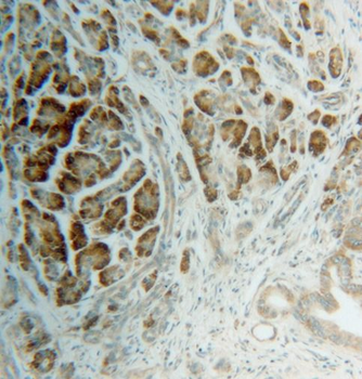RPS4X Rabbit Polyclonal Antibody