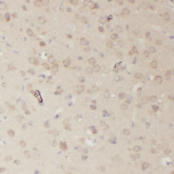 RRP7A Rabbit Polyclonal Antibody