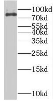 RPS6KA2 Antibody