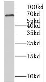 RTKN2 Rabbit Polyclonal Antibody