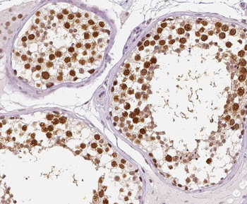 RTKN2 Rabbit Polyclonal Antibody