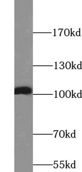 RTN3 Rabbit Polyclonal Antibody