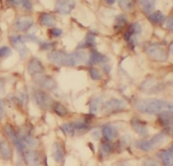 RTN3 Rabbit Polyclonal Antibody