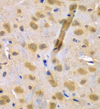 RUFY1 Rabbit Polyclonal Antibody