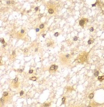 RUFY2 Rabbit Polyclonal Antibody