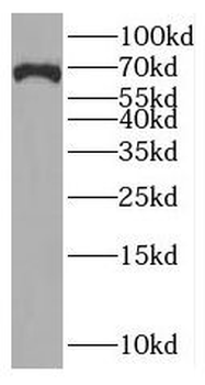 RUFY2 Rabbit Polyclonal Antibody