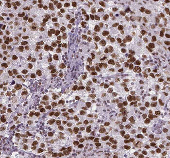 RUFY2 Rabbit Polyclonal Antibody
