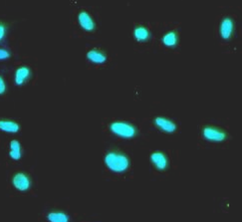 RUVBL1 Rabbit Polyclonal Antibody