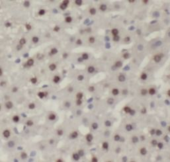RUVBL1 Rabbit Polyclonal Antibody
