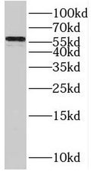 RXRB Rabbit Polyclonal Antibody