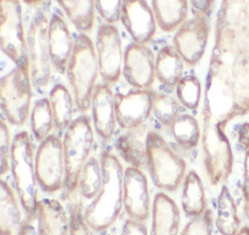 RYK Rabbit Polyclonal Antibody