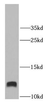 S100A11 Rabbit Polyclonal Antibody