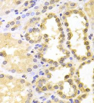 S100A11 Rabbit Polyclonal Antibody