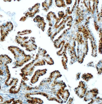 S100A13 Rabbit Polyclonal Antibody