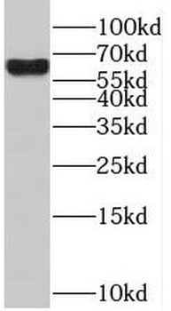 SACM1L Rabbit Polyclonal Antibody