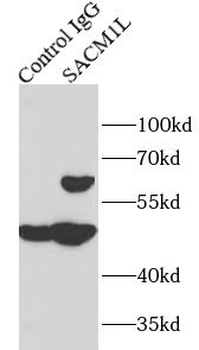 SACM1L Rabbit Polyclonal Antibody