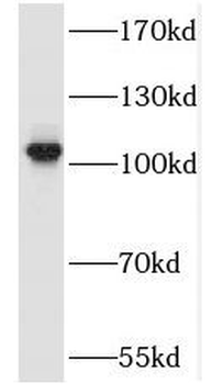 SALL2 Rabbit Polyclonal Antibody