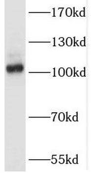 SALL2 Rabbit Polyclonal Antibody