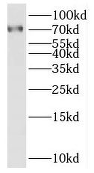 SAMD11 Rabbit Polyclonal Antibody