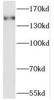 SAMD9 Rabbit Polyclonal Antibody