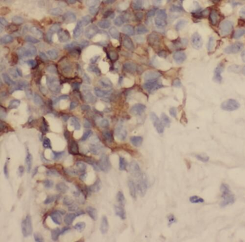 SAMD9L Antibody