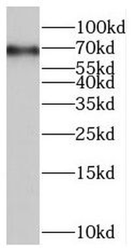 SAMHD1 Rabbit Polyclonal Antibody