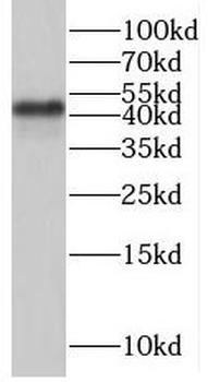SAMSN1 Rabbit Polyclonal Antibody