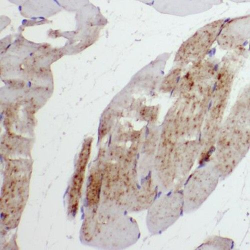 SAR1A Rabbit Polyclonal Antibody