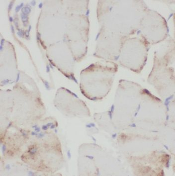 SAR1A Rabbit Polyclonal Antibody