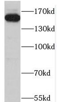 ZFYVE9 Rabbit Polyclonal Antibody