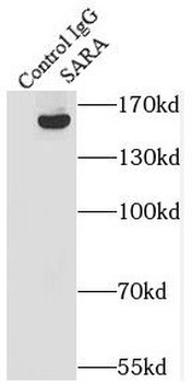 ZFYVE9 Rabbit Polyclonal Antibody