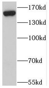 ZFYVE9 Rabbit Polyclonal Antibody