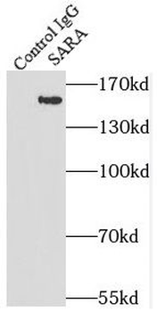 ZFYVE9 Rabbit Polyclonal Antibody