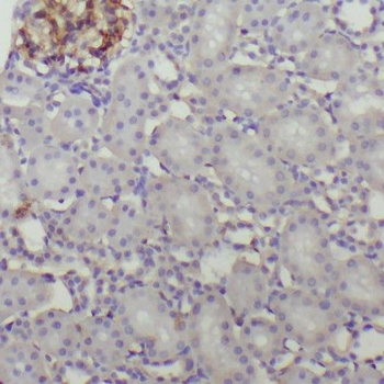 ZFYVE9 Rabbit Polyclonal Antibody