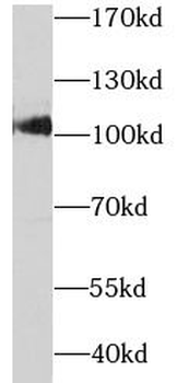 SARDH Rabbit Polyclonal Antibody