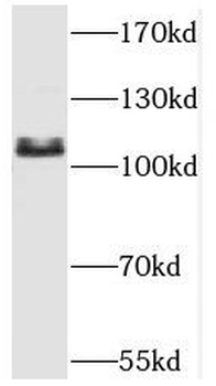 SART1 Rabbit Polyclonal Antibody
