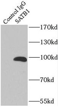 SATB1 Antibody