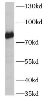 SCARF1 Rabbit Polyclonal Antibody