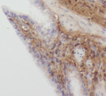 SCARF1 Rabbit Polyclonal Antibody