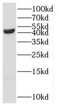 SCCPDH Rabbit Polyclonal Antibody