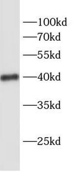 SCD Rabbit Polyclonal Antibody